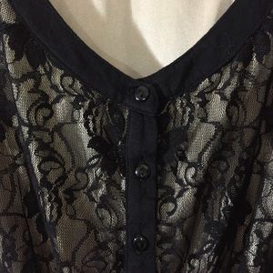 UO Lace Dress